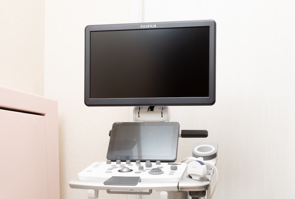 超音波診断装置(エコー)