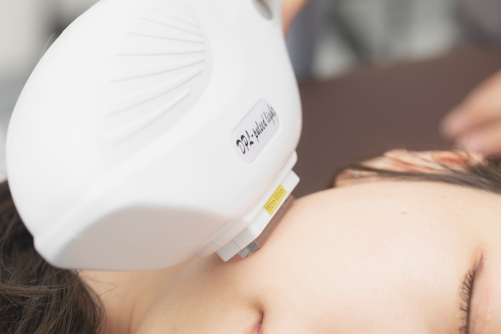 カスタマイザーIPL(光治療)とは?