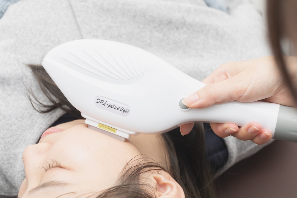 カスタマイザー（IPL光治療）