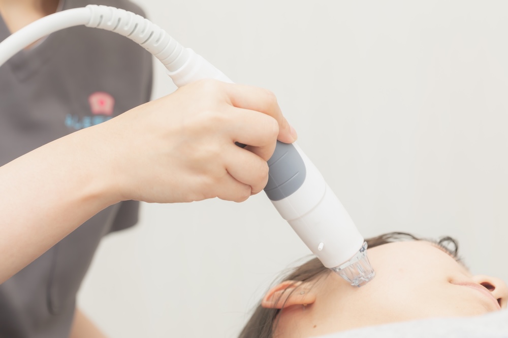 サーマニードルEvo