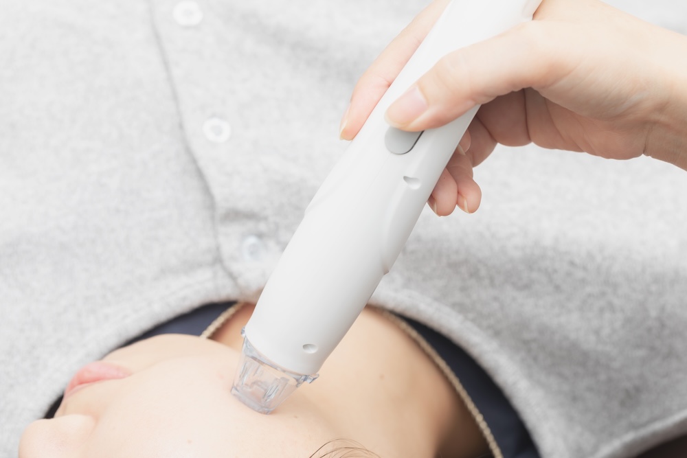 サーマニードルEvo